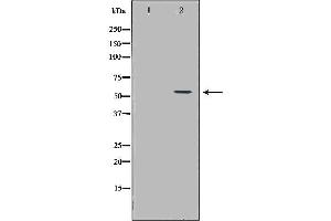 Western blot analysis of A549 cell lysate, using ICAM1 Antibody. (ICAM1 Antikörper  (C-Term))