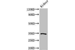 Western Blot Positive WB detected in: Mouse kidney tissue All lanes: KLF7 antibody at 3 μg/mL Secondary Goat polyclonal to rabbit IgG at 1/50000 dilution Predicted band size: 34, 30, 25, 31, 14, 10 kDa Observed band size: 34 kDa (KLF7 Antikörper  (AA 114-220))