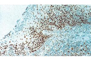 Human tonsil: immunohistochemical staining for Retinoblastoma Gene Protein. (Retinoblastoma Protein (Rb) Antikörper  (N-Term))