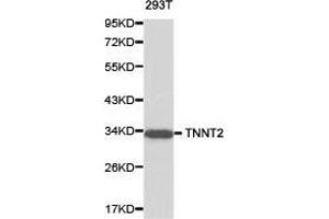 Western Blotting (WB) image for anti-Cardiac Troponin T (cTnT) antibody (ABIN1875151) (Cardiac Troponin T2 Antikörper)