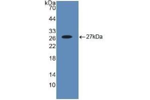 Detection of Recombinant Bid, Human using Polyclonal Antibody to BH3 Interacting Domain Death Agonist (Bid) (BID Antikörper  (AA 1-195))