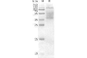 WB analysis of Human CD37-Nanodisc with anti-CD37 monoclonal antibody (ABIN7093065 and ABIN7272595), followed by Goat Anti-Human IgG HRP at 1/5000 dilution (CD37 Protein)