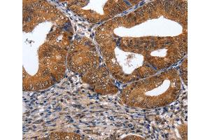 Immunohistochemistry (IHC) image for anti-GATA Binding Protein 6 (GATA6) antibody (ABIN2431397) (GATA6 Antikörper)