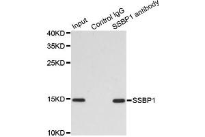 Immunoprecipitation analysis of 200 μg extracts of MCF7 cells using 1 μg SSBP1 antibody (ABIN5974202). (SSBP1 Antikörper)