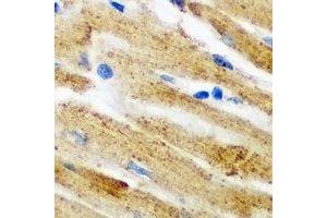 Immunohistochemical analysis of PICOT staining in mouse heart formalin fixed paraffin embedded tissue section. (GLRX3 Antikörper)