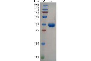Human GRP Protein, hFc Tag on SDS-PAGE under reducing condition. (Gastrin-Releasing Peptide Protein (GRP) (AA 24-50) (Fc Tag))