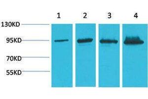 Western Blotting (WB) image for anti-Catenin, beta (CATNB) antibody (ABIN3181549) (beta Catenin Antikörper)