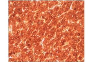 Image no. 1 for anti-alpha-Fetoprotein (AFP) antibody (ABIN950378) (alpha Fetoprotein Antikörper)