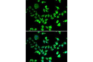 Immunofluorescence analysis of U2OS cells using SMC1A antibody. (SMC1A Antikörper)