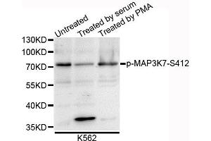Western blot analysis of extracts of K562 cells, using Phospho-MAP3K7-S412 antibody. (MAP3K7 Antikörper  (pSer439))