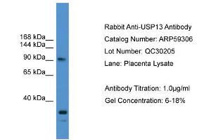 WB Suggested Anti-USP13  Antibody Titration: 0. (USP13 Antikörper  (N-Term))