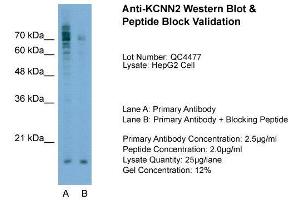 Host:  Rabbit  Target Name:  KCNN2  Sample Type:  HepG2  Lane A:  Primary Antibody  Lane B:  Primary Antibody + Blocking Peptide  Primary Antibody Concentration:  2. (KCNN2 Antikörper  (C-Term))
