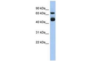 Image no. 1 for anti-Arachidonate 15-Lipoxygenase (ALOX15) (AA 539-588) antibody (ABIN6743958) (ALOX15 Antikörper  (AA 539-588))