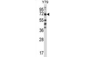 Western Blotting (WB) image for anti-Phenylalanyl-tRNA Synthetase, beta Subunit (FARSB) antibody (ABIN2997725) (FARSB Antikörper)