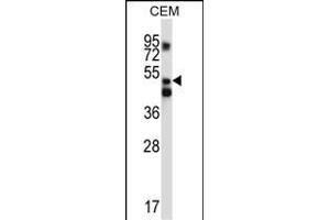 XPNPEP3 Antibody (C-term) (ABIN657127 and ABIN2846271) western blot analysis in CEM cell line lysates (35 μg/lane). (XPNPEP3 Antikörper  (C-Term))