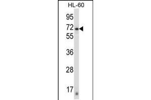 Western blot analysis in HL-60 cell line lysates (35ug/lane). (ZNF415 Antikörper  (N-Term))