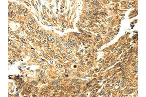 Immunohistochemistry (IHC) image for anti-serpin Peptidase Inhibitor, Clade A (Alpha-1 Antiproteinase, Antitrypsin), Member 12 (SERPINA12) antibody (ABIN5959975) (SERPINA12 Antikörper)