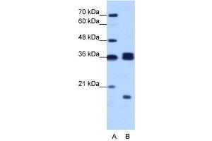 WB Suggested Anti-HNRPH3  Antibody Titration: 1. (HNRNPH3 Antikörper  (N-Term))