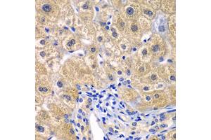 Immunohistochemistry of paraffin-embedded human liver injury using CARD11 antibody. (CARD11 Antikörper)