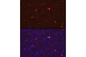 Immunofluorescence analysis of rat brain cells using /IB Rabbit pAb (2391) at dilution of 1:50 (40x lens). (Iba1 Antikörper  (AA 1-147))