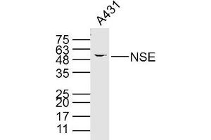 A431 cell lysates probed with PNSE (15E2) Monoclonal Antibody, unconjugated (bsm-33072M) at 1:300 overnight at 4°C followed by a conjugated secondary antibody for 60 minutes at 37°C. (ENO2/NSE Antikörper)