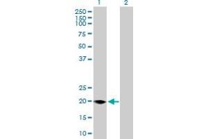 Western Blot analysis of FMO9P expression in transfected 293T cell line by FMO9P MaxPab polyclonal antibody. (FMO9P Antikörper  (AA 1-160))