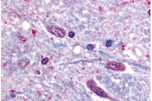 Human Spinal Cord (formalin-fixed, paraffin-embedded) stained with SLC5A3 antibody ABIN213396 at 40 ug/ml followed by biotinylated goat anti-rabbit IgG secondary antibody ABIN481713, alkaline phosphatase-streptavidin and chromogen. (SLC5A3 Antikörper  (C-Term))