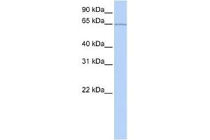 WB Suggested Anti-KIAA0020 Antibody Titration:  0. (KIAA0020 Antikörper  (Middle Region))