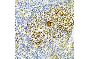 Immunohistochemistry of paraffin-embedded rat spleen using TNFRSF11B Antibody (ABIN3022914, ABIN3022915, ABIN3022916 and ABIN6219293) at dilution of 1:200 (40x lens). (Osteoprotegerin Antikörper  (AA 22-280))