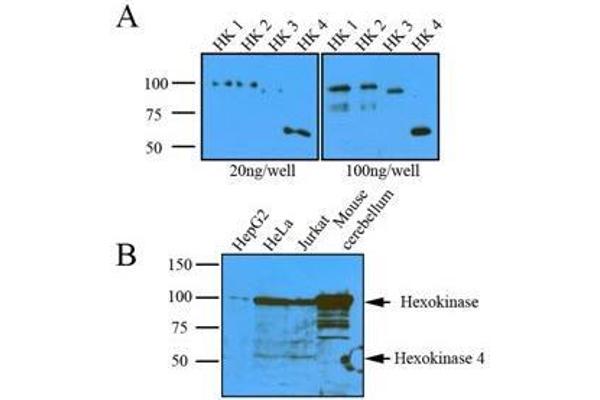 Hexokinase Antikörper  (AA 1-917)