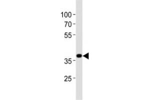 Western blot analysis of lysate from mouse stomach tissue lysate using Nkx2. (NK2 Homeobox 5 Antikörper  (AA 192-235))