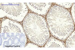 Immunohistochemical analysis of paraffin-embedded rat testis tissue. (Dynamin 1-Like Antikörper)