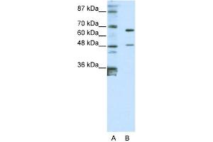 WB Suggested Anti-ZNF597 Antibody Titration:  0. (ZNF597 Antikörper  (N-Term))
