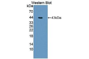 Western blot analysis of the recombinant protein. (MTR Antikörper  (AA 923-1265))