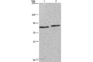 Western blot analysis of 293T and K562 cell, using ITGB2 Polyclonal Antibody at dilution of 1:600 (Integrin beta 2 Antikörper)