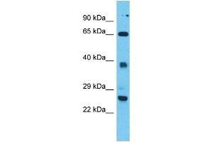 Western Blotting (WB) image for anti-Tetratricopeptide Repeat Domain 26 (TTC26) (N-Term) antibody (ABIN2500795) (TTC26 Antikörper  (N-Term))