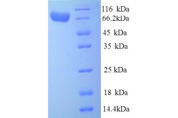 IDUA Protein (AA 28-653) (His tag)