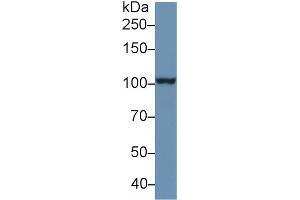 Western blot analysis of Human PANC1 cell lysate, using Human PSA Antibody (1 µg/ml) and HRP-conjugated Goat Anti-Rabbit antibody ( (NPEPPS Antikörper  (AA 141-272))