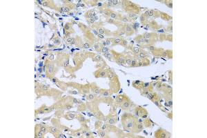 Immunohistochemistry of paraffin-embedded human stomach using HS1BP3 antibody (ABIN5974534) at dilution of 1/100 (40x lens). (HS1BP3 Antikörper)