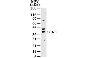 Image no. 1 for anti-Chemokine (C-C Motif) Receptor 5 (CCR5) (AA 324-340) antibody (ABIN208379) (CCR5 Antikörper  (AA 324-340))