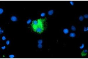 Image no. 3 for anti-Carboxypeptidase A1 (Pancreatic) (CPA1) antibody (ABIN1497592) (CPA1 Antikörper)