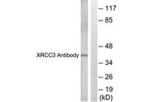 Western blot analysis of extracts from HepG2 cells, treated with Adriamycin 0. (RCC3 (AA 41-90) Antikörper)