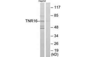 Western Blotting (WB) image for anti-Nerve Growth Factor Receptor (NGFR) (AA 121-170) antibody (ABIN2889383) (NGFR Antikörper  (AA 121-170))