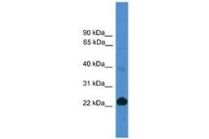 Image no. 1 for anti-CD8a Molecule (CD8A) (AA 61-110) antibody (ABIN6745481) (CD8 alpha Antikörper  (AA 61-110))