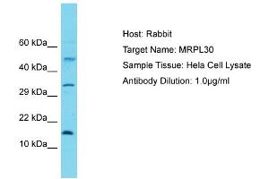Host: Rabbit Target Name: MRPL30 Sample Tissue: Human Hela Whole Cell Antibody Dilution: 1ug/ml (MRPL30 Antikörper  (C-Term))