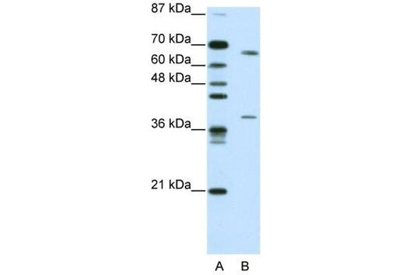 GRHL3 Antikörper  (C-Term)