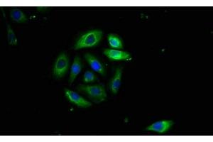 Immunofluorescence staining of A549 cells with ABIN7173891 at 1:400, counter-stained with DAPI. (FAS Antikörper  (AA 26-171))