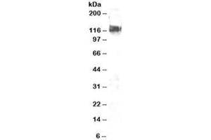 Western blot testing of NIH3T3 lysate with CBL antibody at 2ug/ml. (CBL Antikörper)