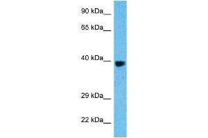 Host:  Rat  Target Name:  FOS  Sample Tissue:  Rat Liver  Antibody Dilution:  1ug/ml (c-FOS Antikörper  (C-Term))
