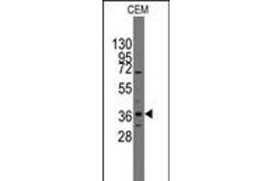 Western blot analysis of anti-Pilx2 Pab in CEM cell line lysates (35ug/lane). (PITX2 Antikörper  (AA 122-151))